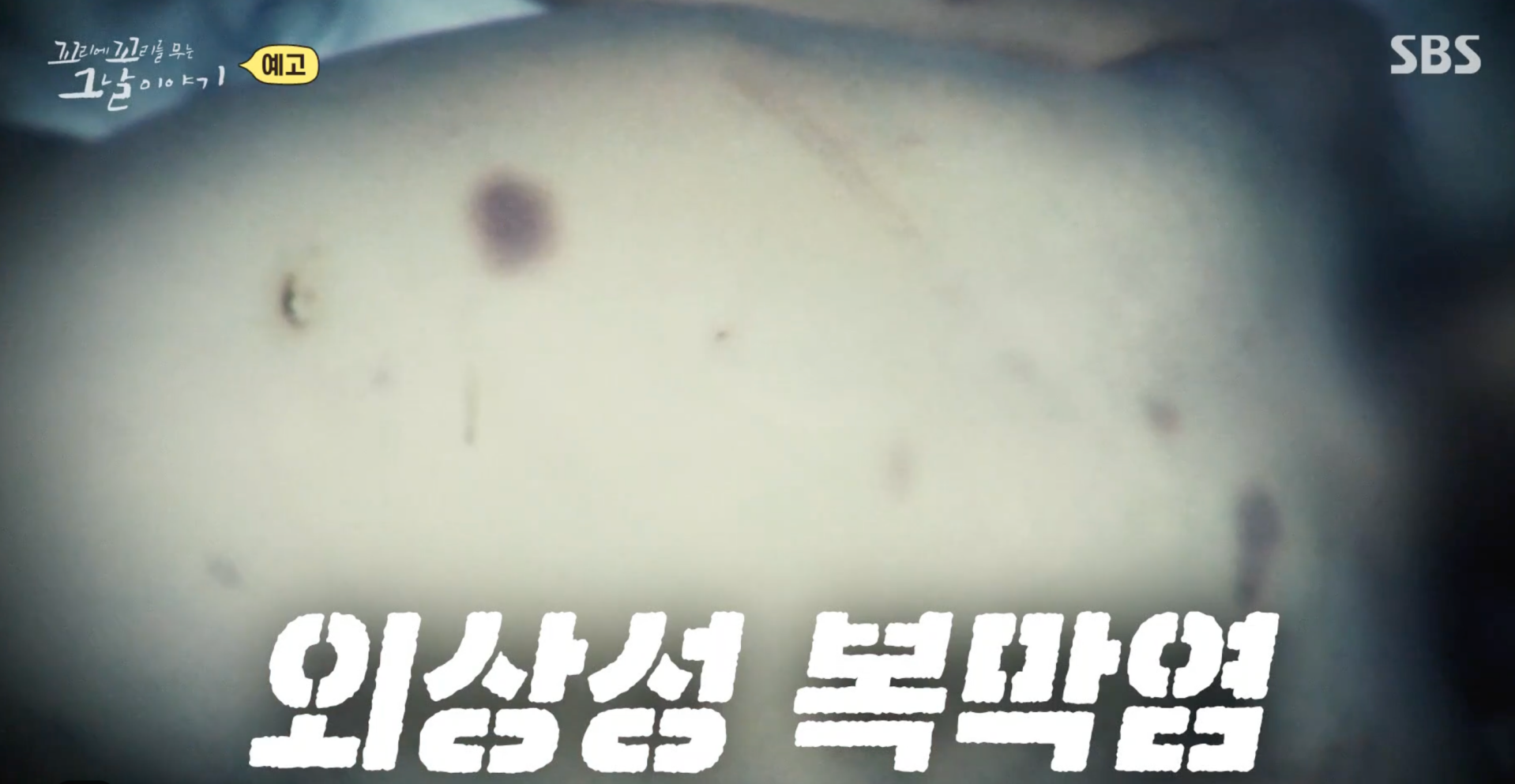 꼬꼬무 칠곡계모 아동학대 사건