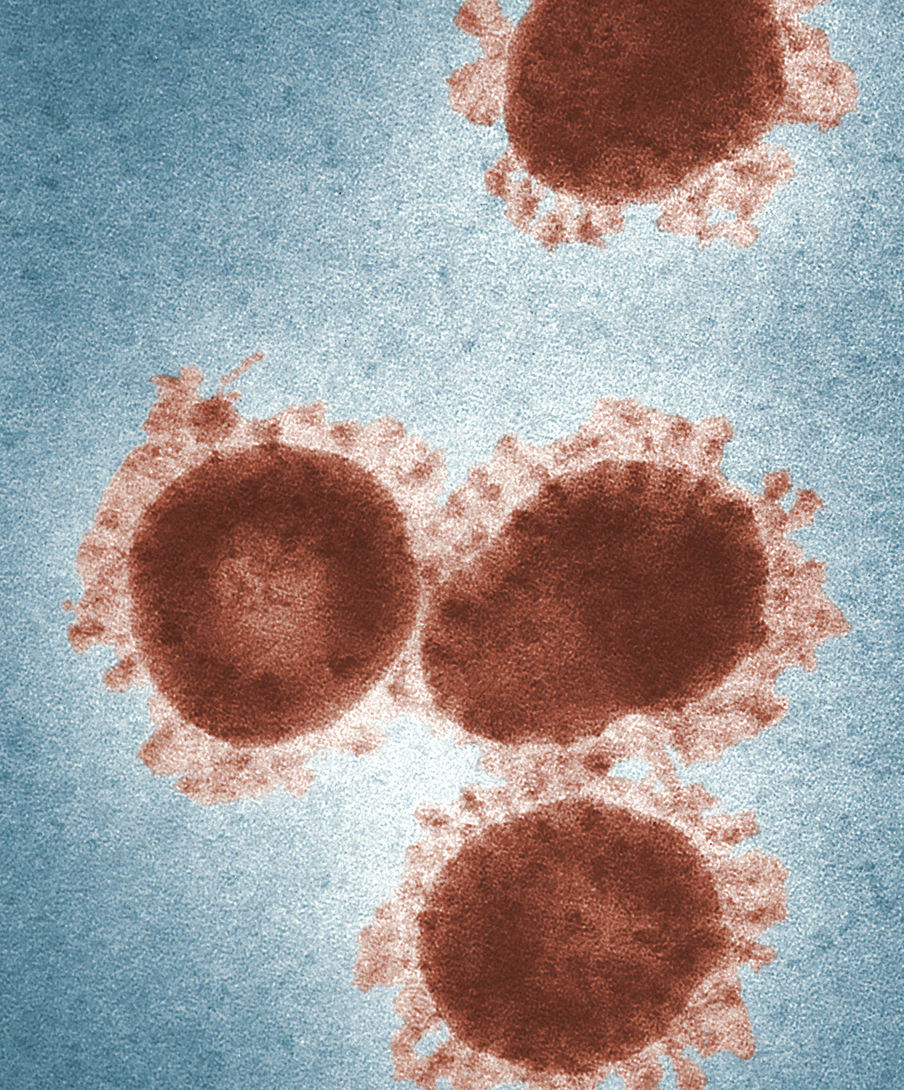 렙토스피라증 원인