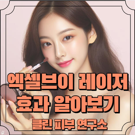 엑셀브이 레이저 효과 알아보기