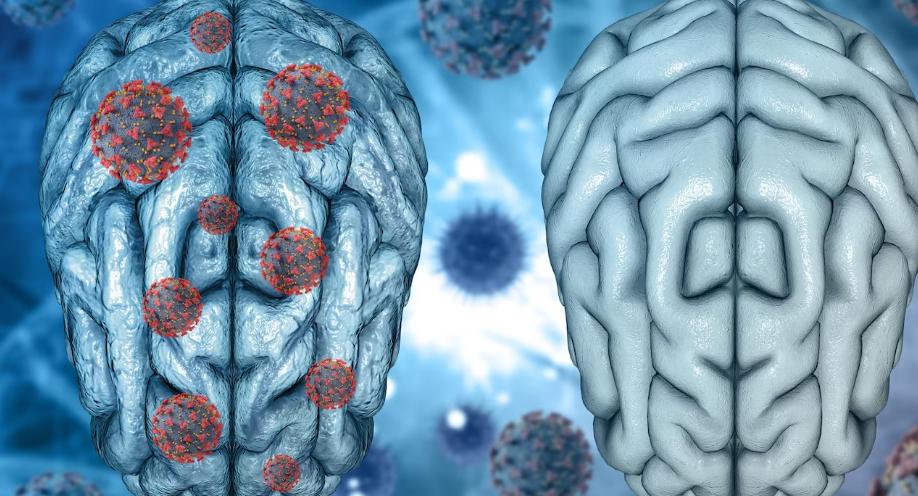 2. 뇌종양의 진단방법