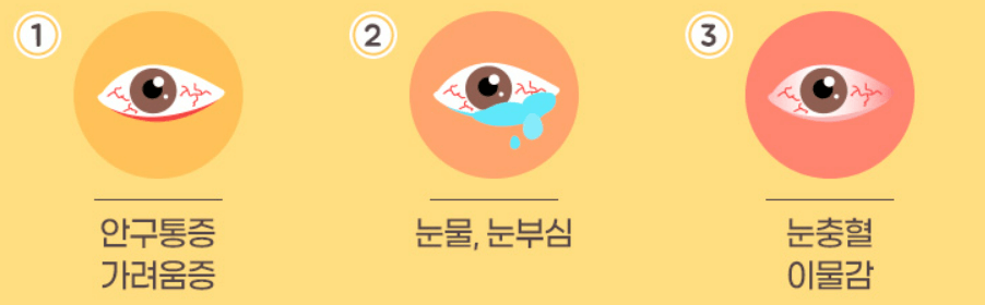 알레르기성 결막염 증상