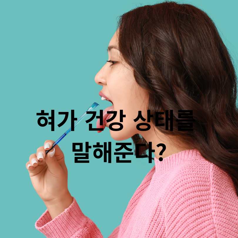 혀 건강 상태 체크법