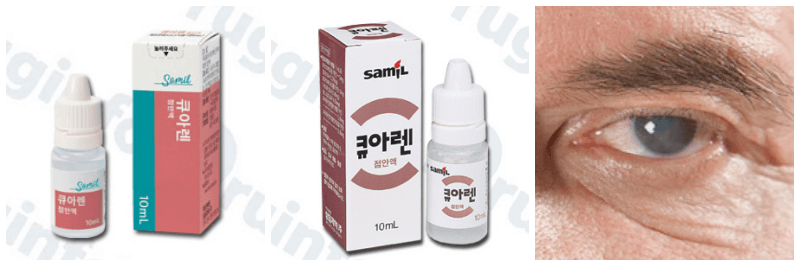 큐아렌점안액, 백내장 사진