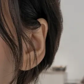 쌍꺼풀 수술 이미지 - 쌍꺼풀 수술을 받은 사람