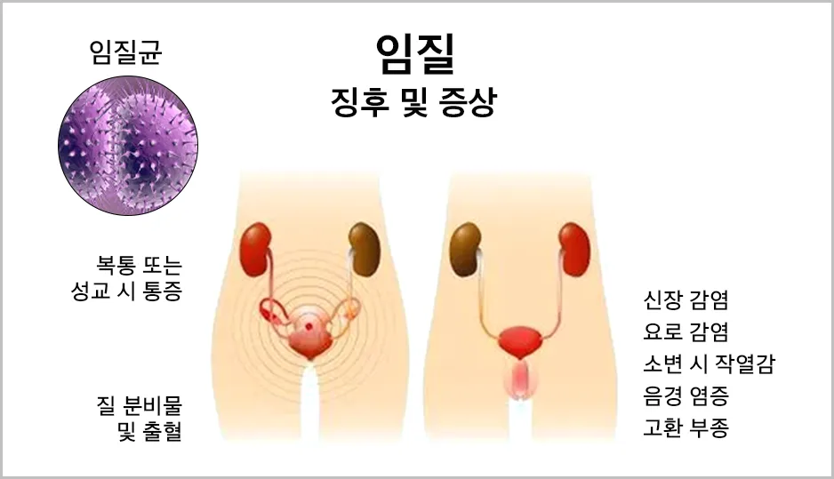 임질-징후-및-증상