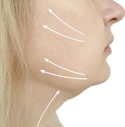 턱살 고민 해결