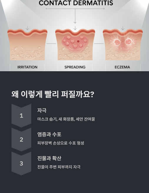 왜 이렇게 빨리 퍼질까요?
