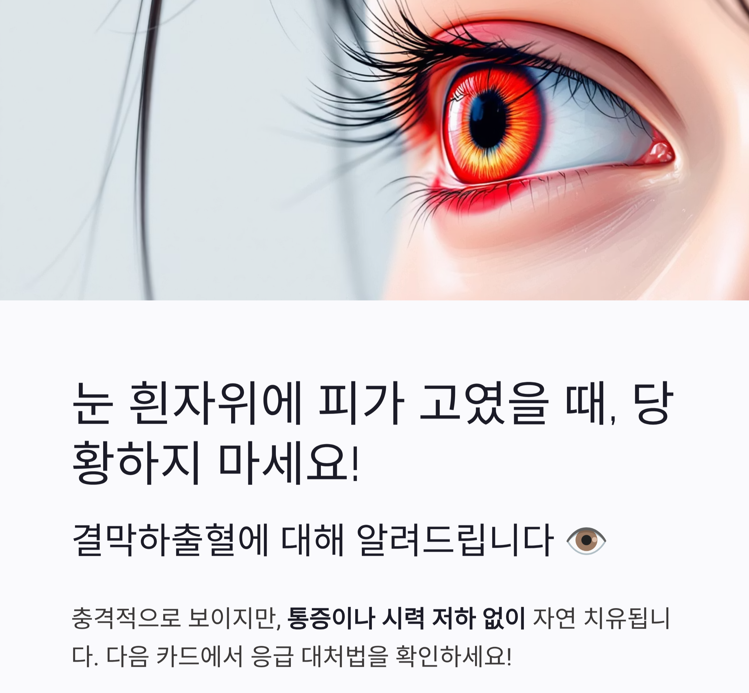 (결막하출혈)