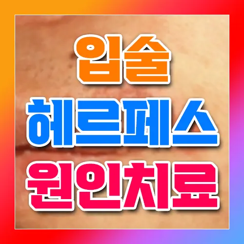 입술 헤르페스 원인 치료