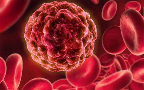 혈액으로 알 수 있는 질병 종류