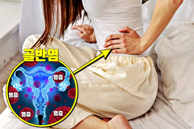 왼쪽 옆구리 통증 의심되는병 골반염 증상, 건강 팁줌 매일꿀정보