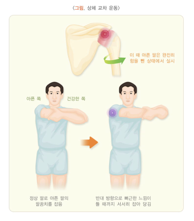 상체 교차 운동