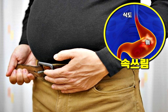 벨트 조이기 복압 속쓰림 원인, 팁줌