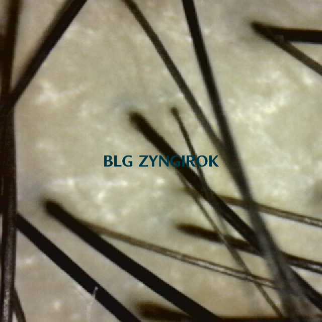 탈모 극복 프로젝트 - 정수리 두피 사진 모습이다.