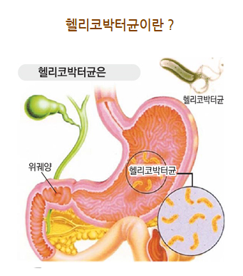 헬리코박터 제균 치료와 골다공증 예방의 관계 관련 이미지