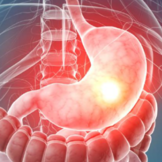 위의 위치와 통증