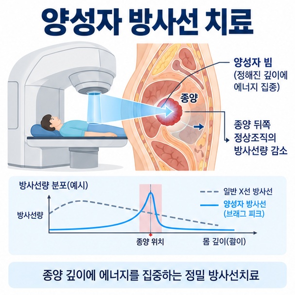 양성자 방사선 치료 원리와 종양에 에너지를 집중해 정상조직 방사선 노출을 줄이는 모습을 보여주는 교육용 이미지