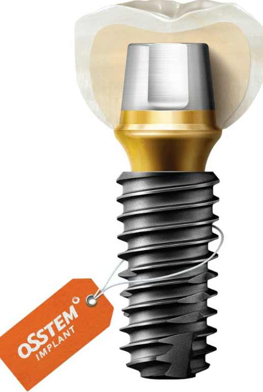 부산해운대구-임플란트-잘하는곳-추천-임플란트가격-임플란트후기 