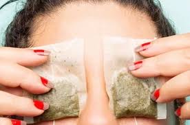 눈 붓기 빨리 빼는법