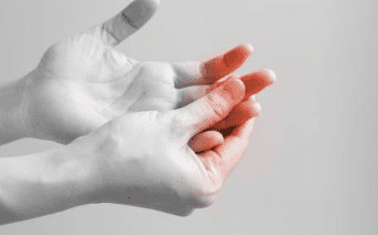 하지 정맥류 증상 수술비용