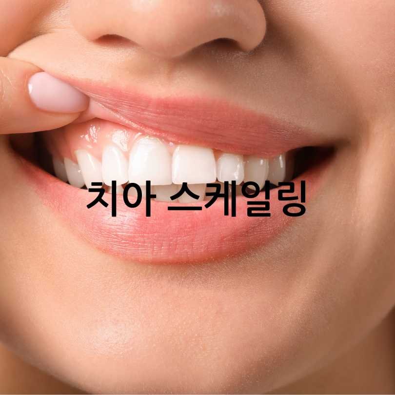 치아 스케일링의 효과와 중요성