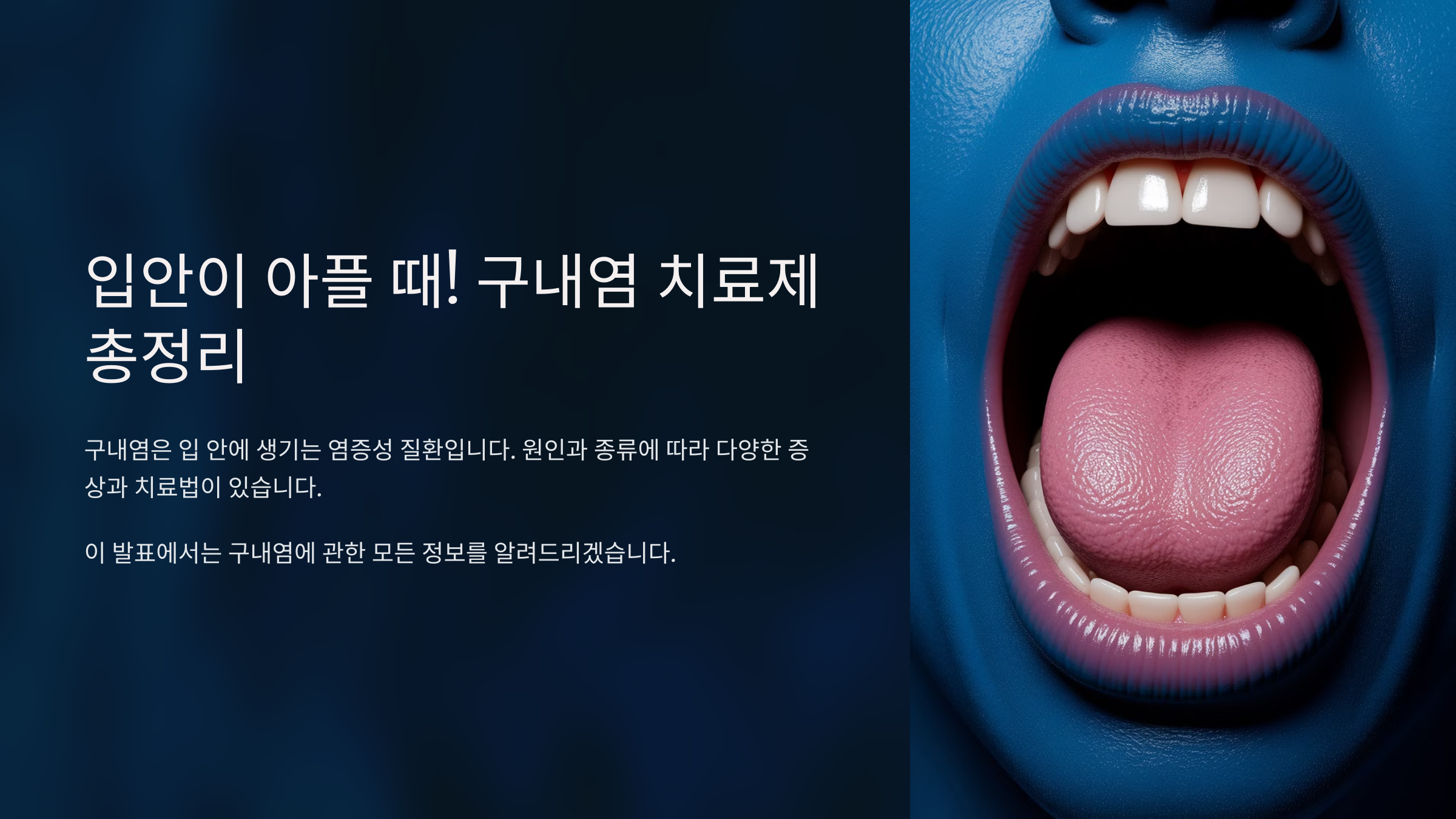 구내염 치료제 총정리