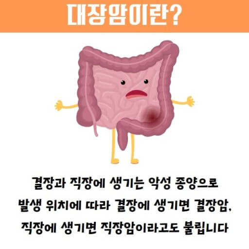 중년이면 대장암 의심