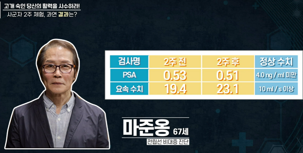 전립선 사군자