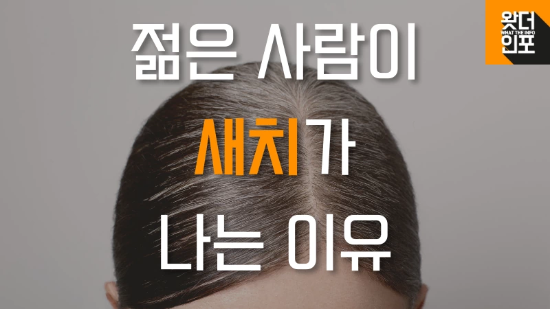 젊은-사람-새치-이유