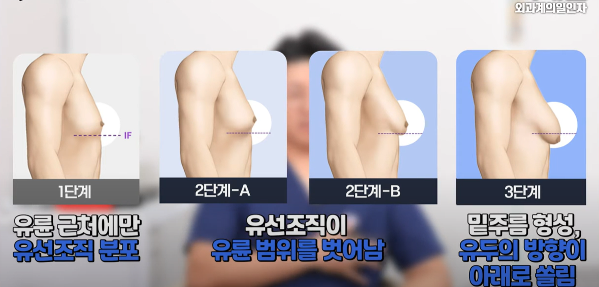 사이먼등급