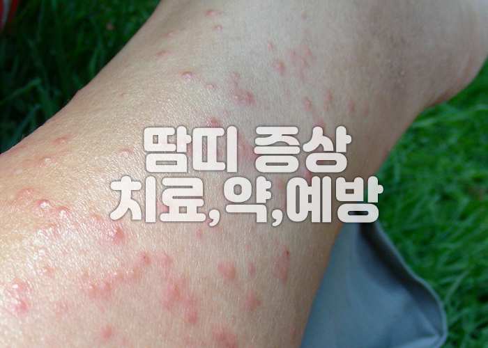 사람의 다리에 땀띠가 가득 퍼져있다