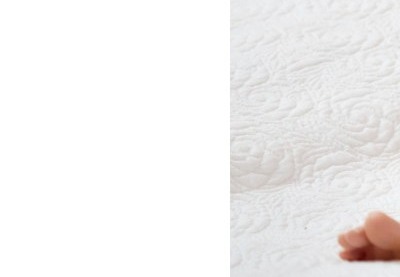 하지 정맥류 증상