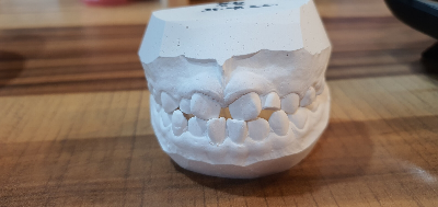 교정 상담 계획