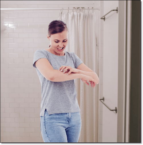 러비지 알레리기 효과