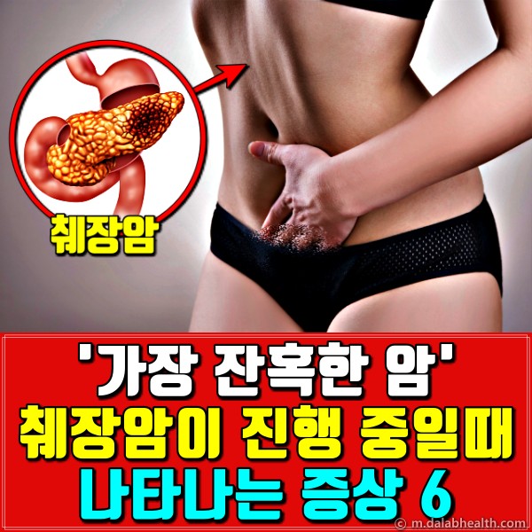 췌장암 증상,췌장암 초기증상,췌장암 자가진단,팁줌
