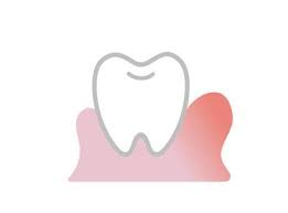 잇몸 염증 치료약 