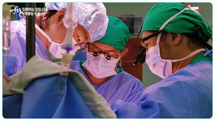 제731화-EBS-명의-간암-재발암-수술