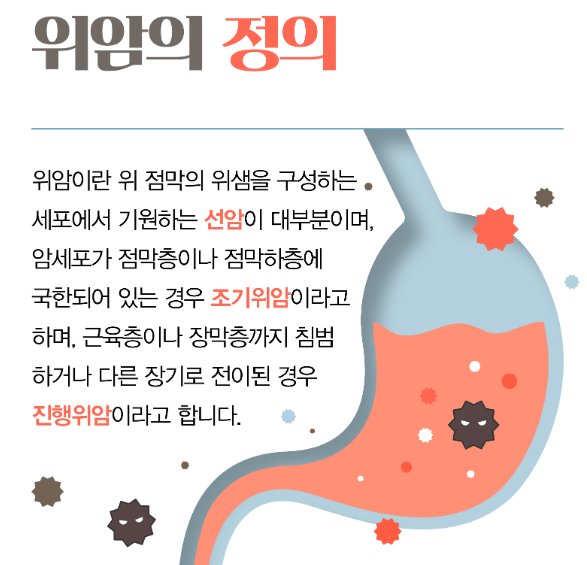 위암 증상
