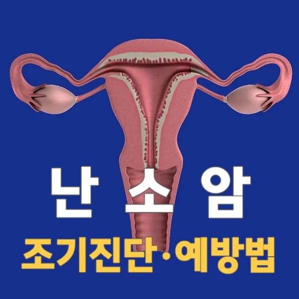 유전성 난소암의 조기진단&#44; 예방법을 안내드립니다!