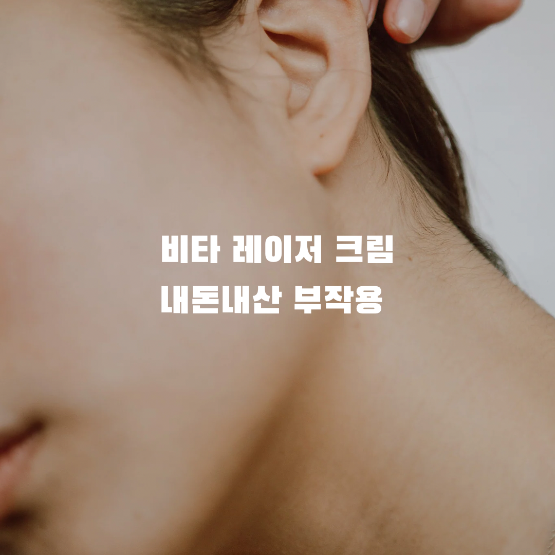 비타 레이저 크림 내돈내산 후기 정보