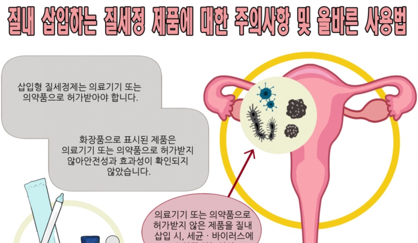 질 세정제 사용법
