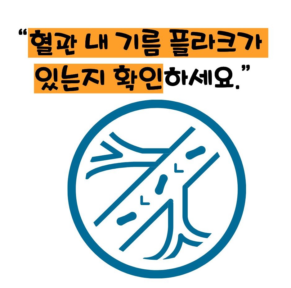 경동맥 초음파 검사로 알수 있는병의 설명