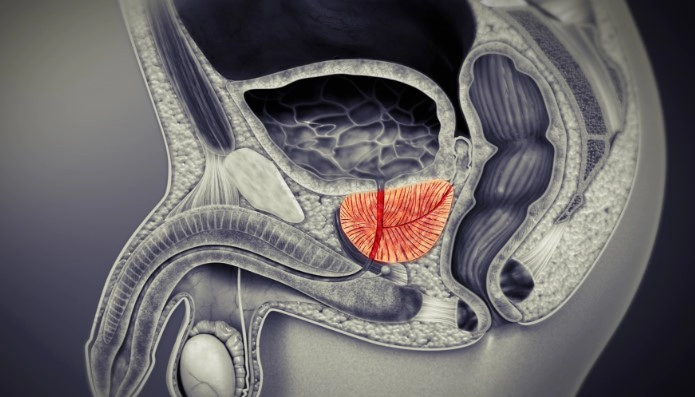 전립선 비대증 증상 발기부전 및 전립선 비대증에 좋은 마사지