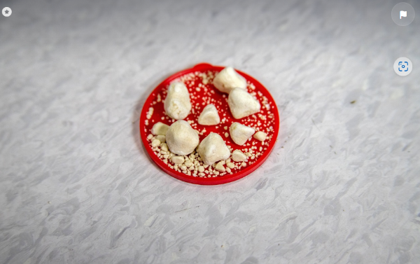 요로 결석 관련 사진