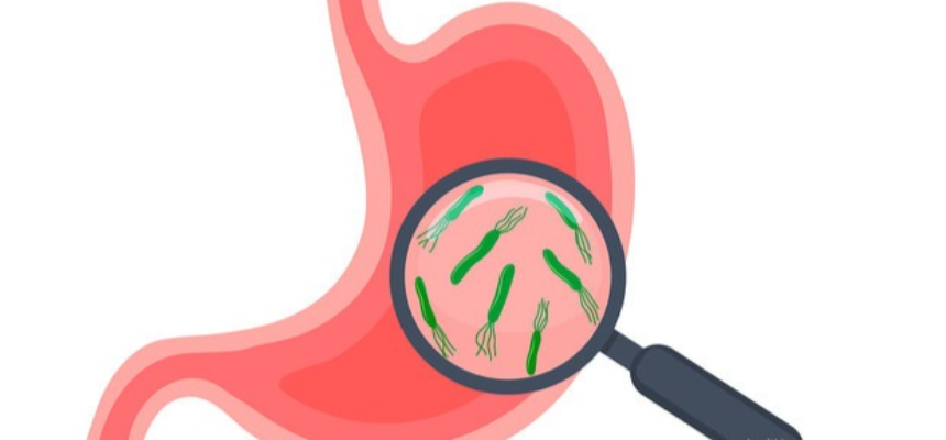 헬리코박터 균 이미지