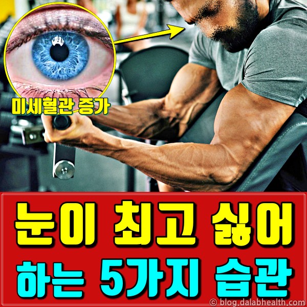 황반변성 증상 원인,눈에 안좋은 운동