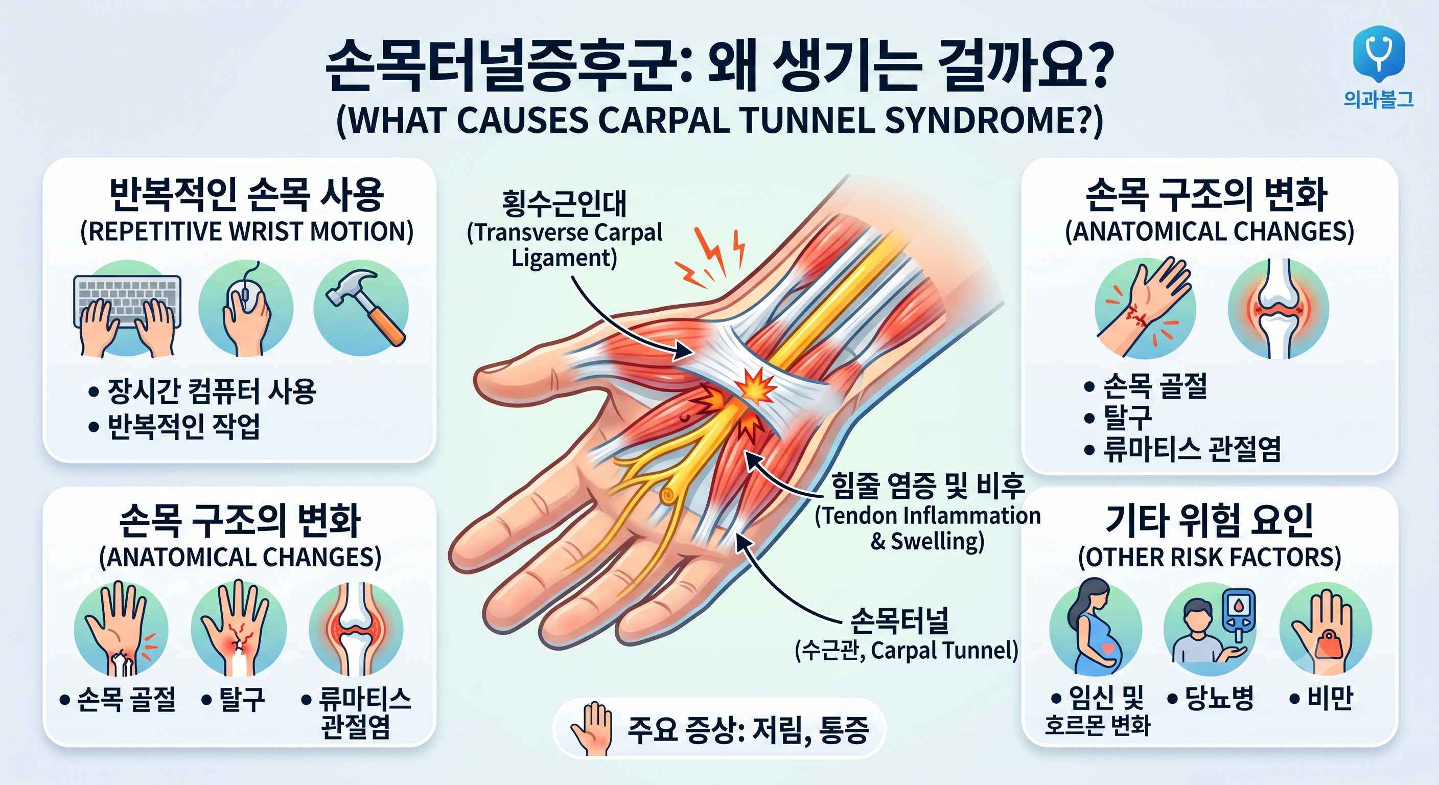 손목터널증후군, 왜 생기는 걸까요?