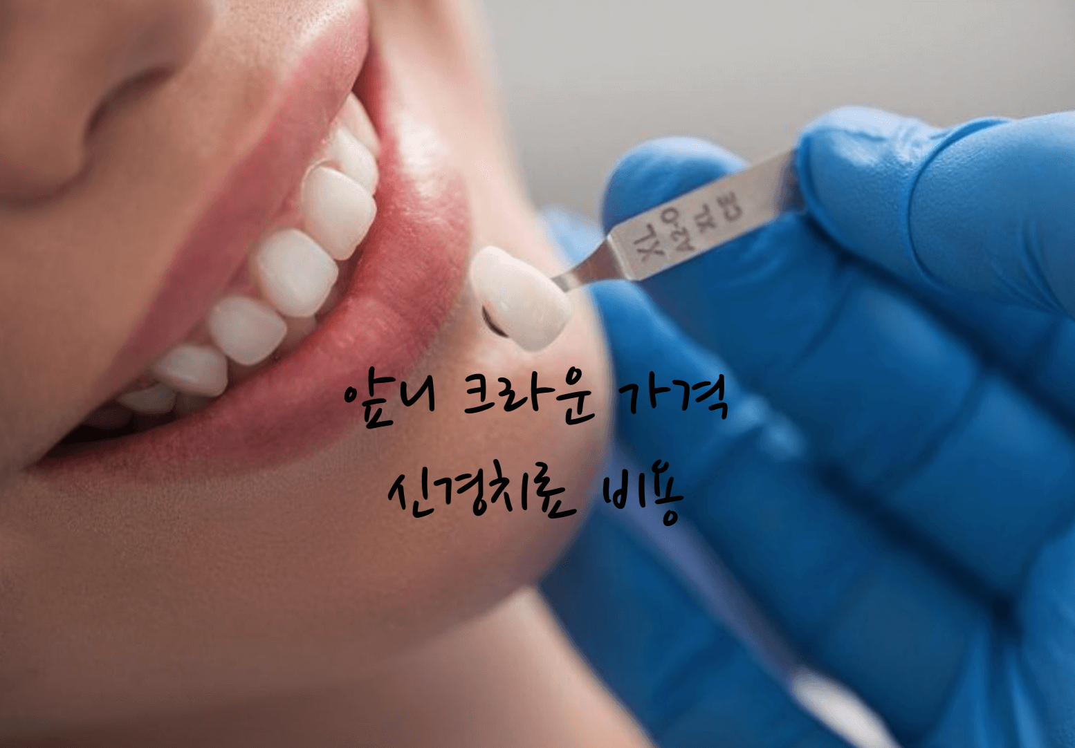 앞니 크라운 가격