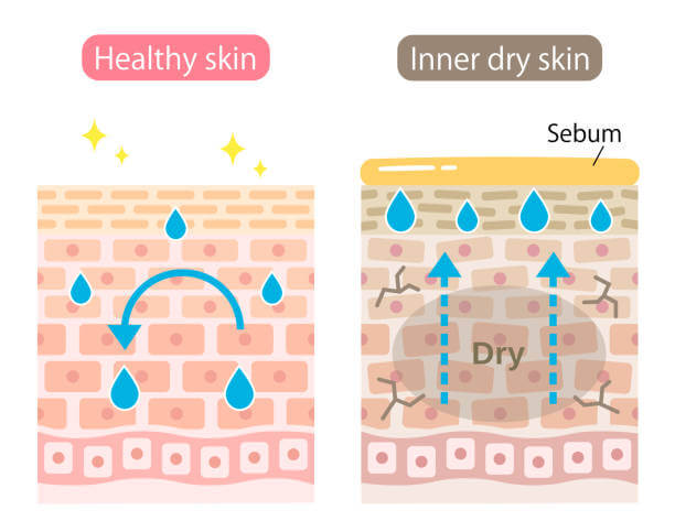 건성 피부 (Dry Skin)