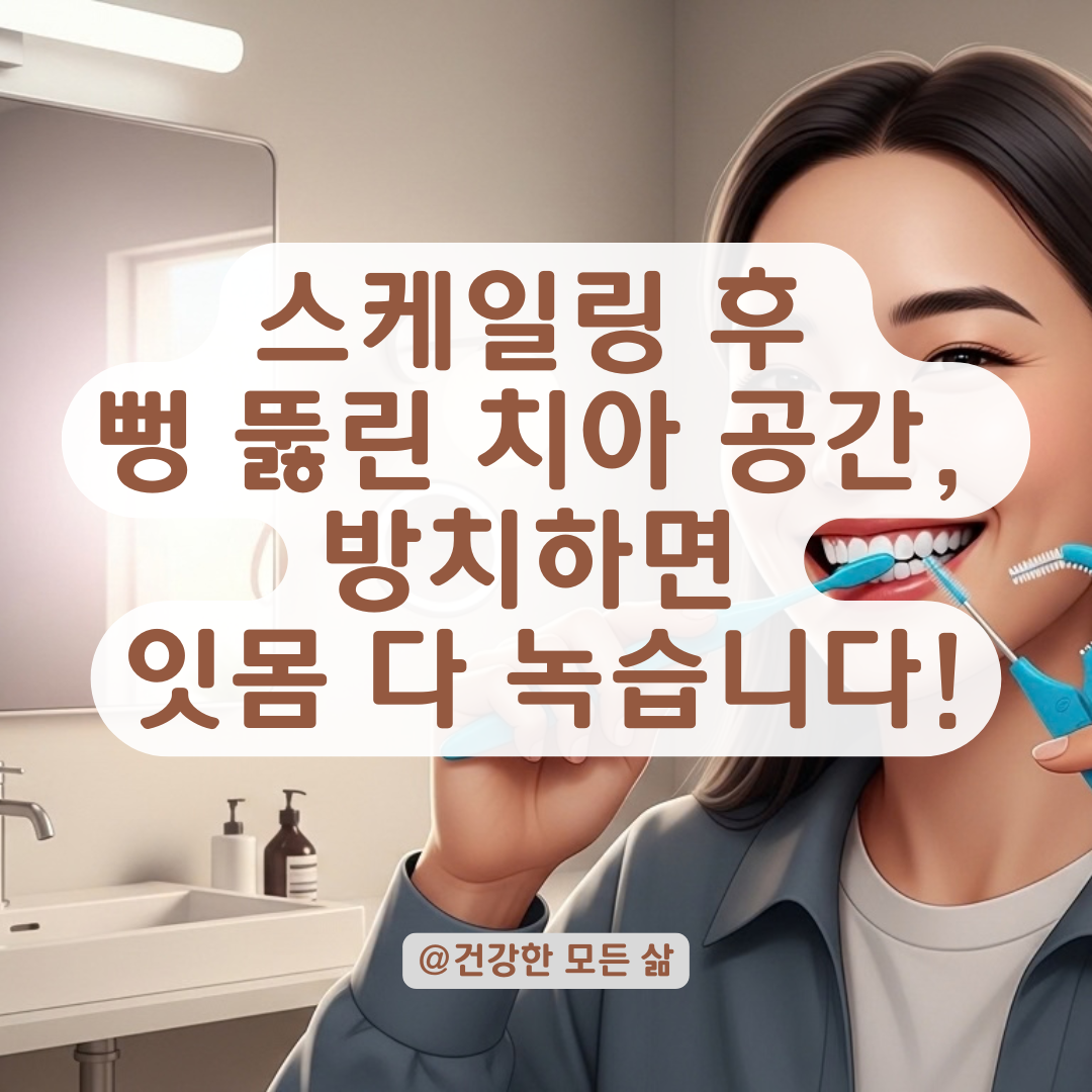 치과 치료 후 드러난 치아 사이 공간을 건강하게 관리하는 수칙